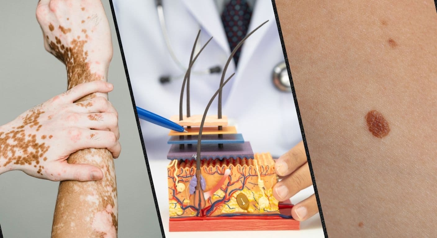 Jaipur SMS Hospital Opens Rs 4.81 Crore Skin Institute for Advanced Treatment